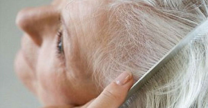 شرایط موهایتان در مورد سلامتی شما چه می گوید؟