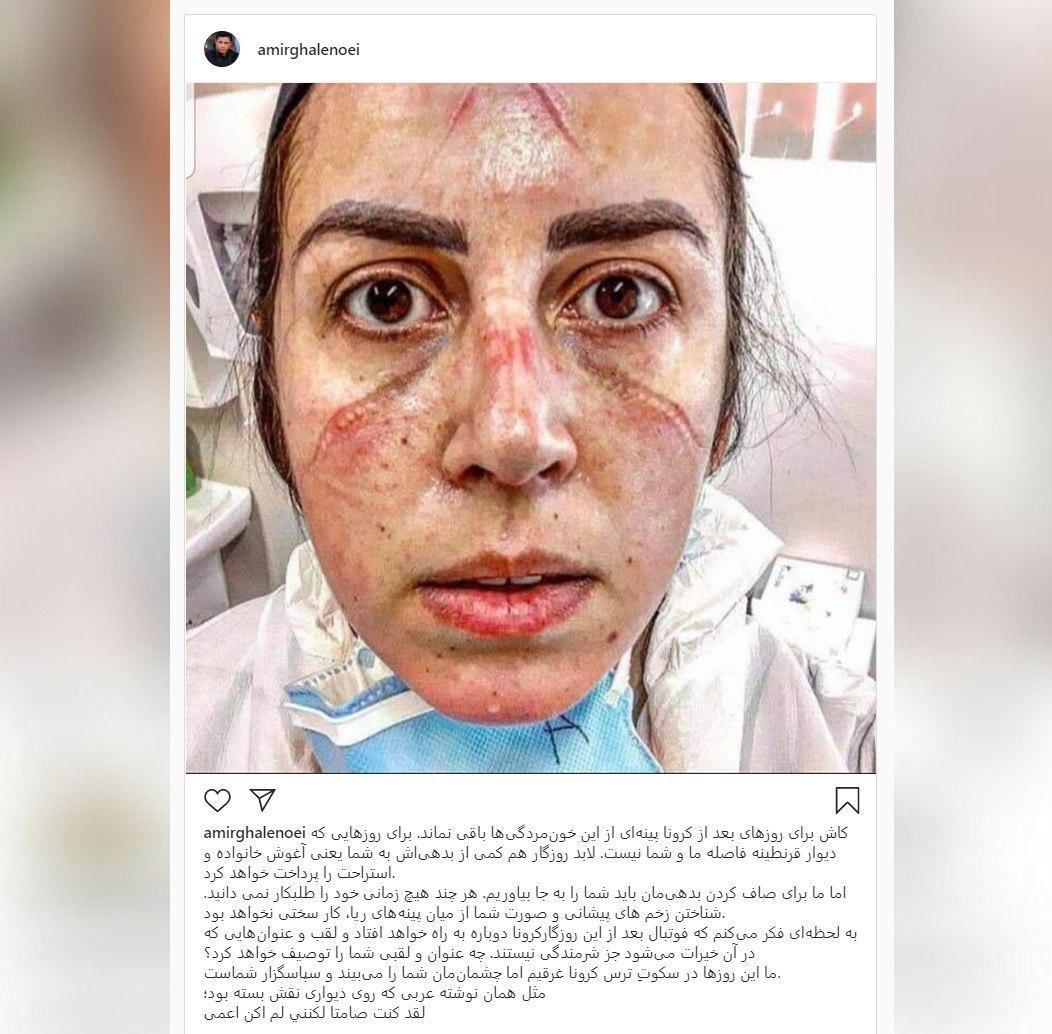 پیام احساسی قلعه‌نویی خطاب به کادر درمان با کنایه به فوتبالیست‌ها/عکس