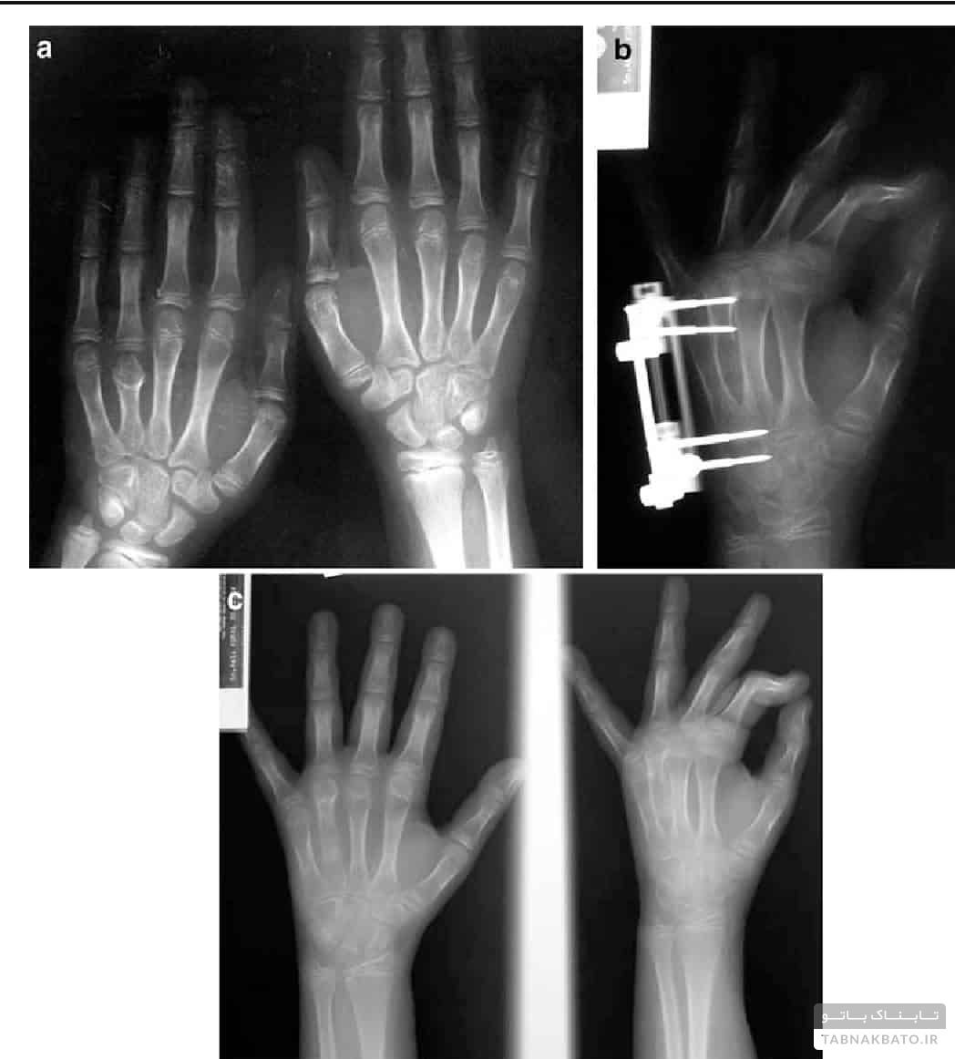 عجیب‌ترین روش‌های درمانی در جهان