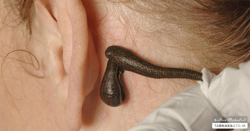 عجیب‌ترین روش‌های درمانی در جهان