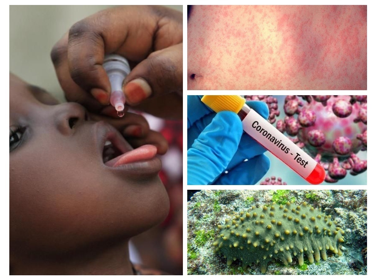 سرخک خطرناک تر از کرونا