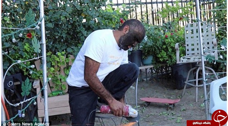 «مرد گرگی» که ۹۸ درصد بدنش را مو پوشانده است+ تصاویر
