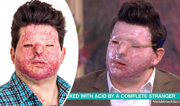 بحران اسیدپاشی و چاقوکشی در لندن/ زیر پوست پایتخت بریتانیا چه می‌گذرد؟ +عکس